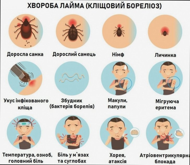 Хвороба Лайма: як розпізнати і не допустити ускладнень